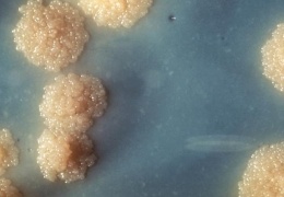 Эстония задумалась об отмене поголовных прививок от туберкулеза