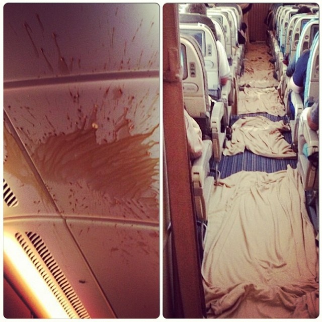 Жуткие последствия турбулентности в самолёте