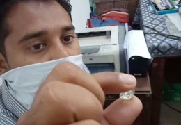  Миллионер из трущоб: шахтер из Индии нашел огромный алмаз и разбогател 