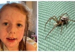  Самый опасный паук Великобритании укусил 5-летнюю девочку